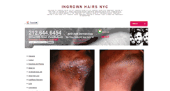 Desktop Screenshot of ingrownhairsnyc.net
