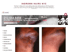 Tablet Screenshot of ingrownhairsnyc.net